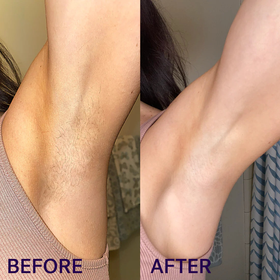 Aureti Nudé Cream