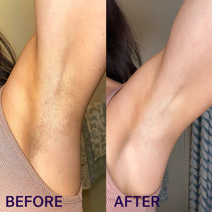 Aureti Nudé Cream