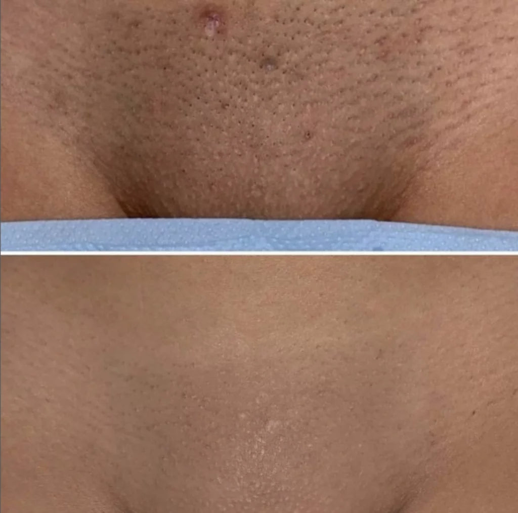 Aureti Nudé Cream