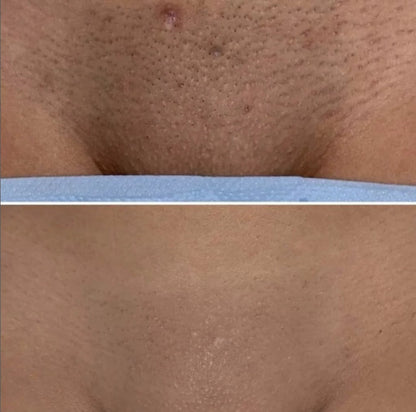 Aureti Nudé Cream